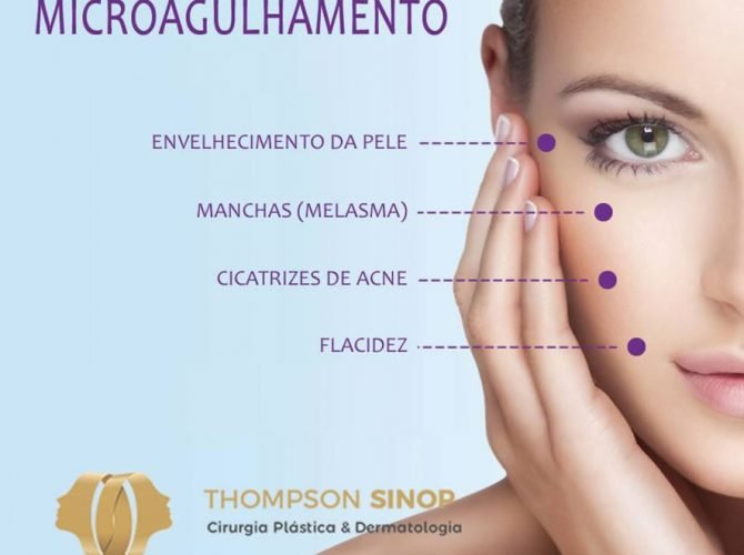microagulhamento em sinop com dermaroller